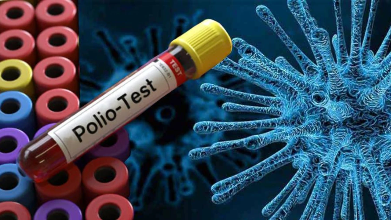 Polio virus in environmental samples of Karachi