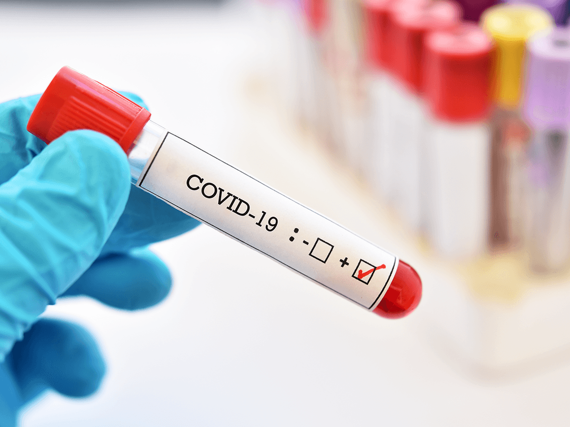 Coronavirus: Pakistan reports 313 new cases as positivity rate remains below 1%