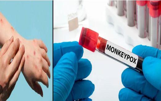 پنجاب حکومت نے منکی پاکس کے حوالے سے کمیٹی تشکیل دے دی
