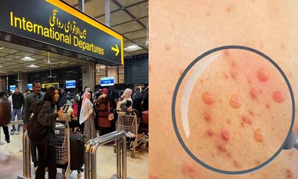 Mpox: New guidelines for airports