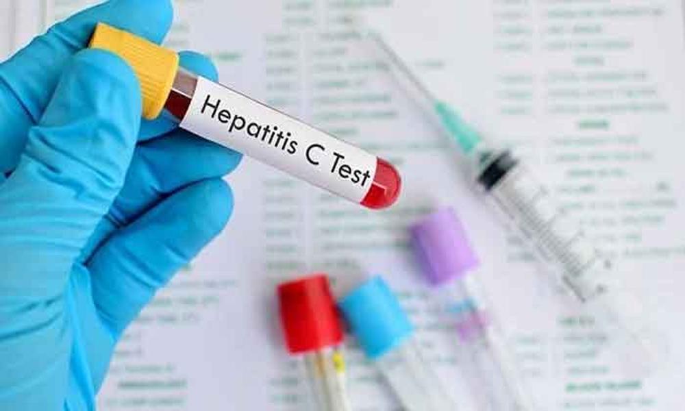 Every 25th Pakistani infected with Hepatitis C