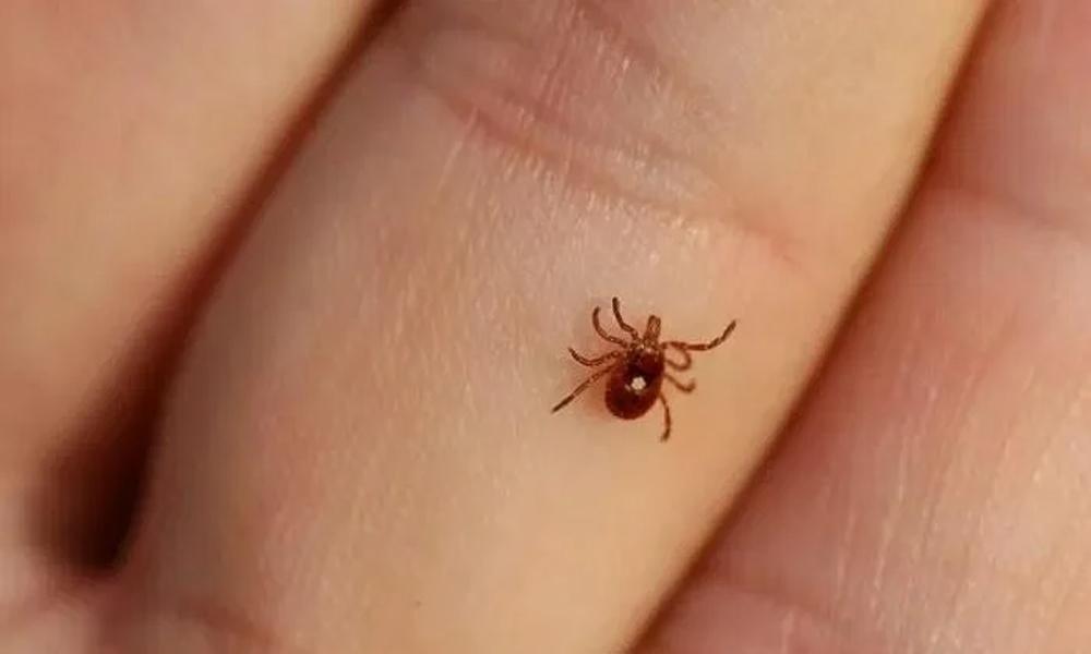 Fourth case of Congo virus reported in Balochistan this year