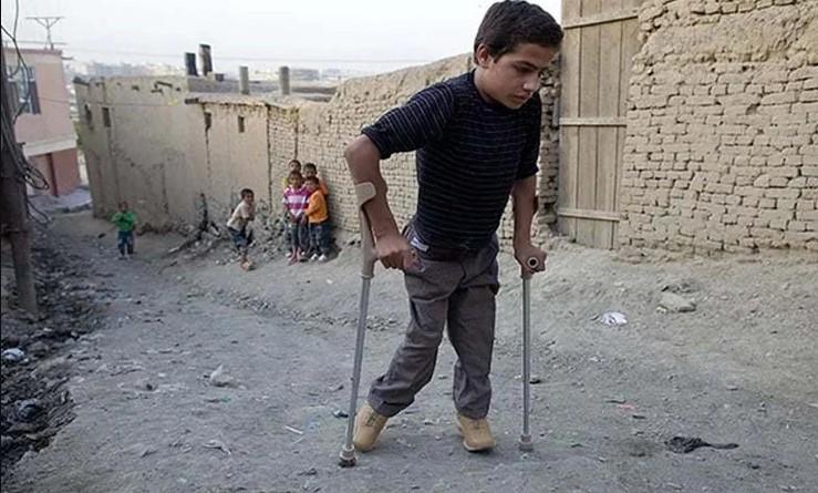First polio case reported in Gilgit-Baltistan