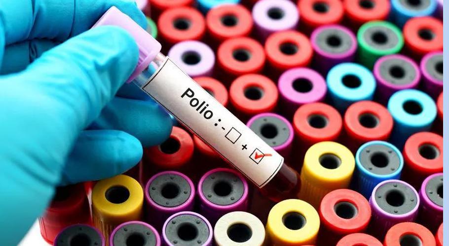 New polio case reported in KP