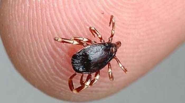 Another Congo virus case emerges in Karachi