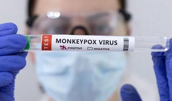Monkeypox case reported in Pakistan