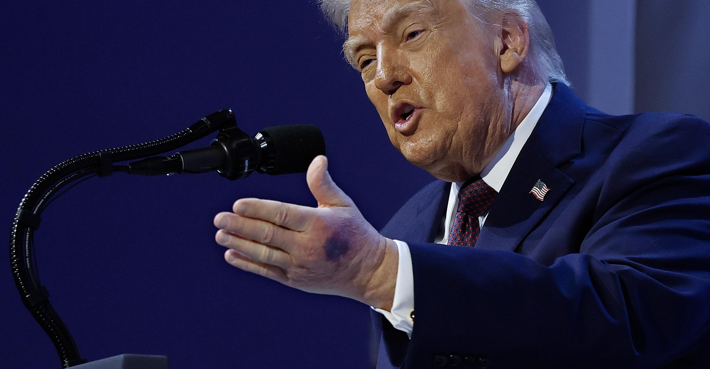 Just how healthy is Donald Trump, really?