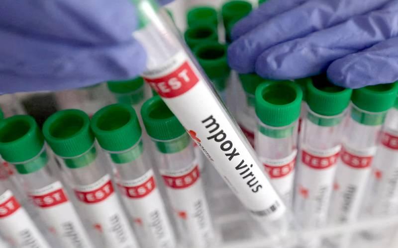 شہر قائد میں منکی پاکس وائرس کا ایک اور کیس سامنے آ گیا 