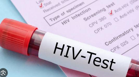 Pakistan: HIV cases reach 250,000, 80pc patients deprived of treatment