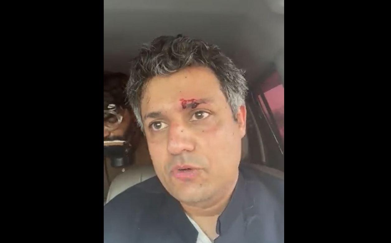 PTI leader Hammad Azhar injured in shelling