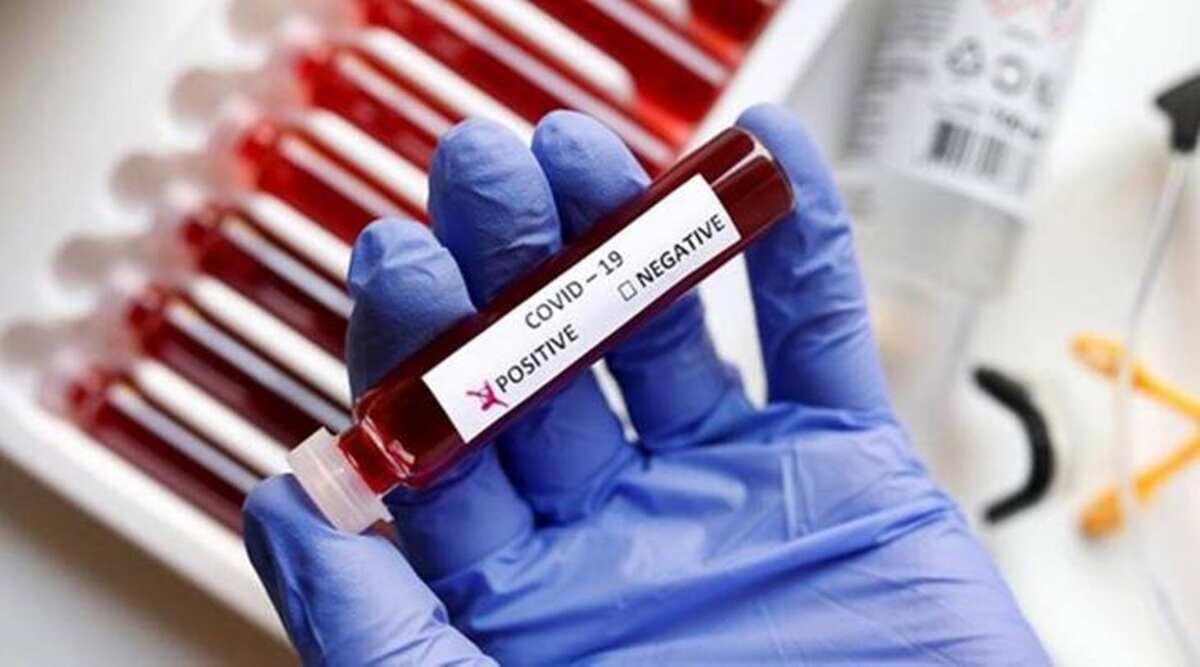 Coronavirus in Pakistan: 58 more succumb to COVID, 2,357 test positive              