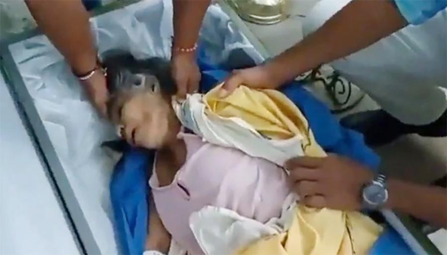 جنازہ اٹھنے سے قبل مردہ خاتون کی سانس بحال