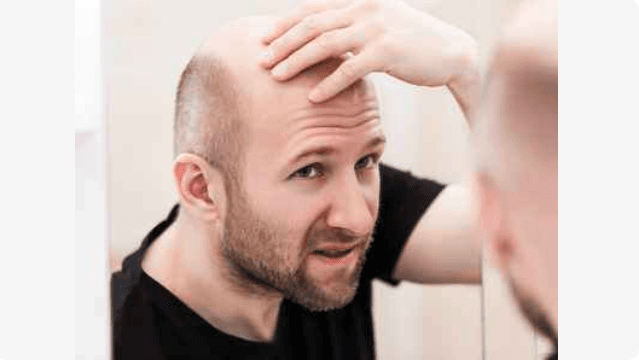 New drug approved to treat baldness