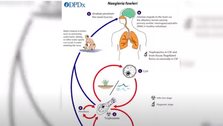 دماغ کھانے  والا کیڑا کراچی سے لاہور پہنچ گیا