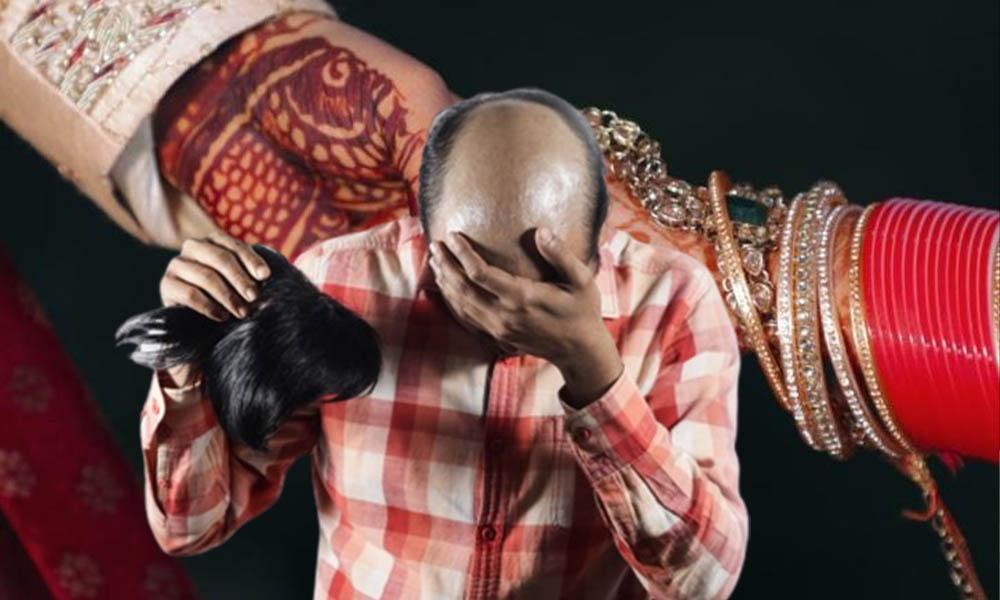 Bride’s family beat the groom for hiding baldness