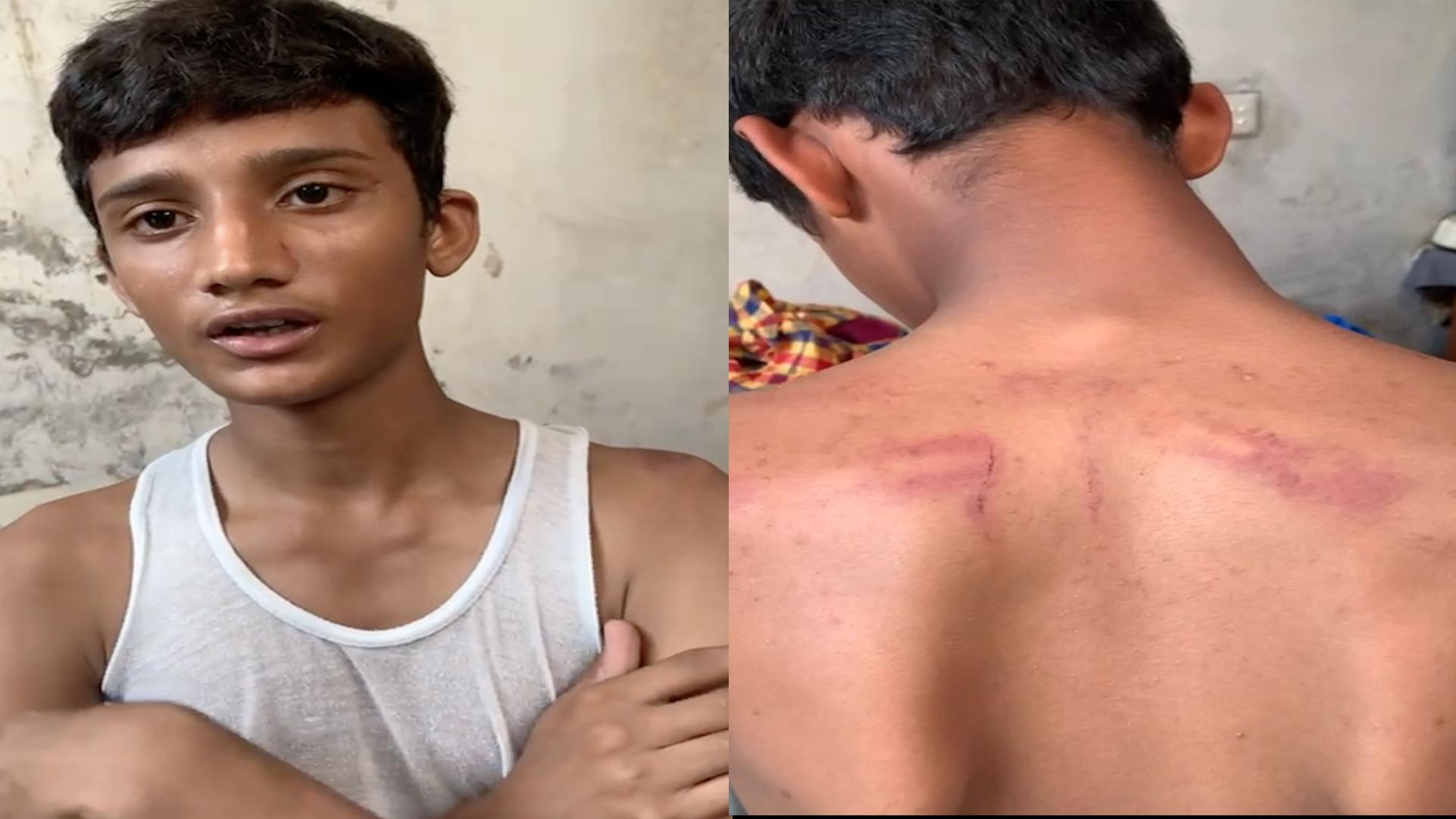 ماموں کا سگے بھانجے پر تشدد،بچے نے بھاگ  جان بچائی