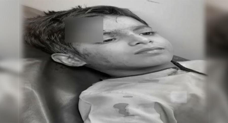 لاہور:  ٹیچر کے تشدد سے طالب علم زخمی