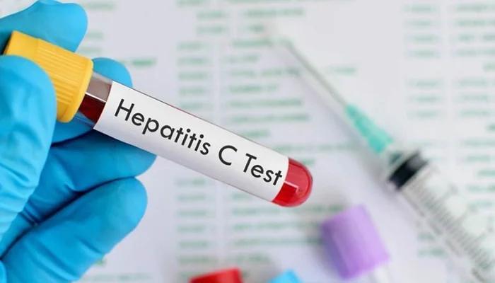 Pakistan becomes first among hepatitis affected countries