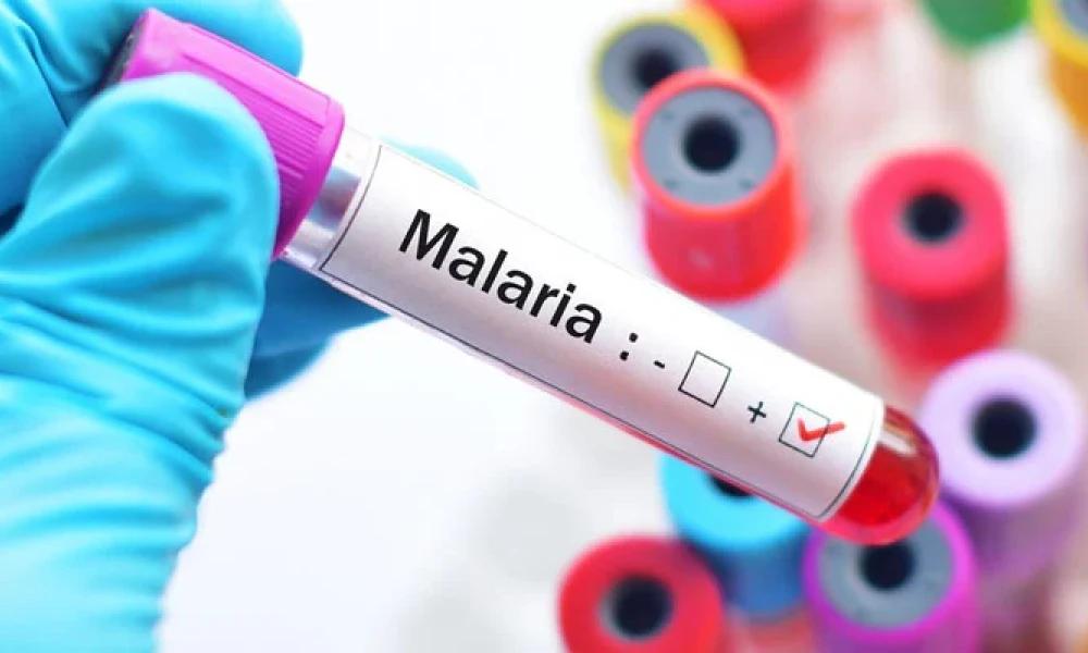 10 more people fell victim to malaria in Karachi