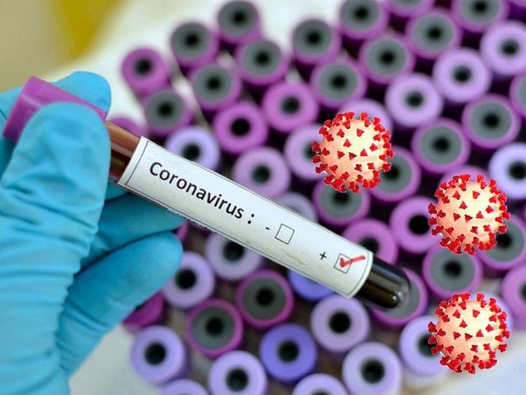 Pakistan reports 411 new coronavirus infections, 7 deaths in 24 hours