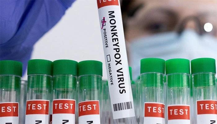 پاکستان میں منکی پاکس کا پہلا مشتبہ کیس رپورٹ ہونے کا انکشاف
