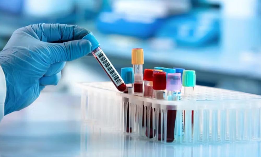 Revolution in medical science, blood group of human kidneys successfully changed