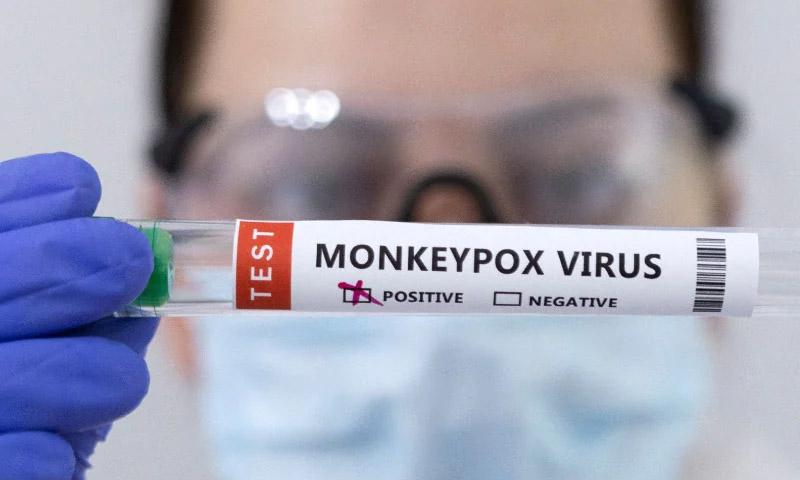 منکی پاکس کے مریضوں کے لئے 21 دن قرنطینہ لازمی