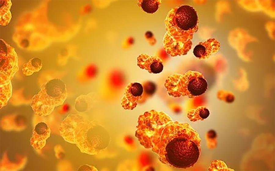 سائنسدانو ں نے کینسر کی نشو ونما میں معاون ثابت ہونے والے عام مدافعتی خلیے کا سراغ لگا لیا