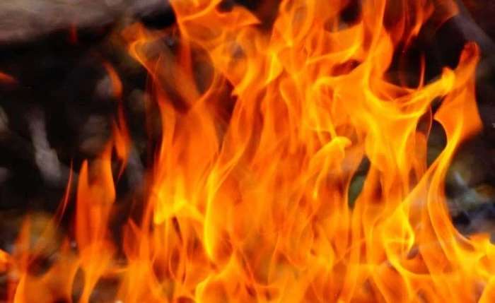 Woman allegedly tortured, set on fire by in-laws