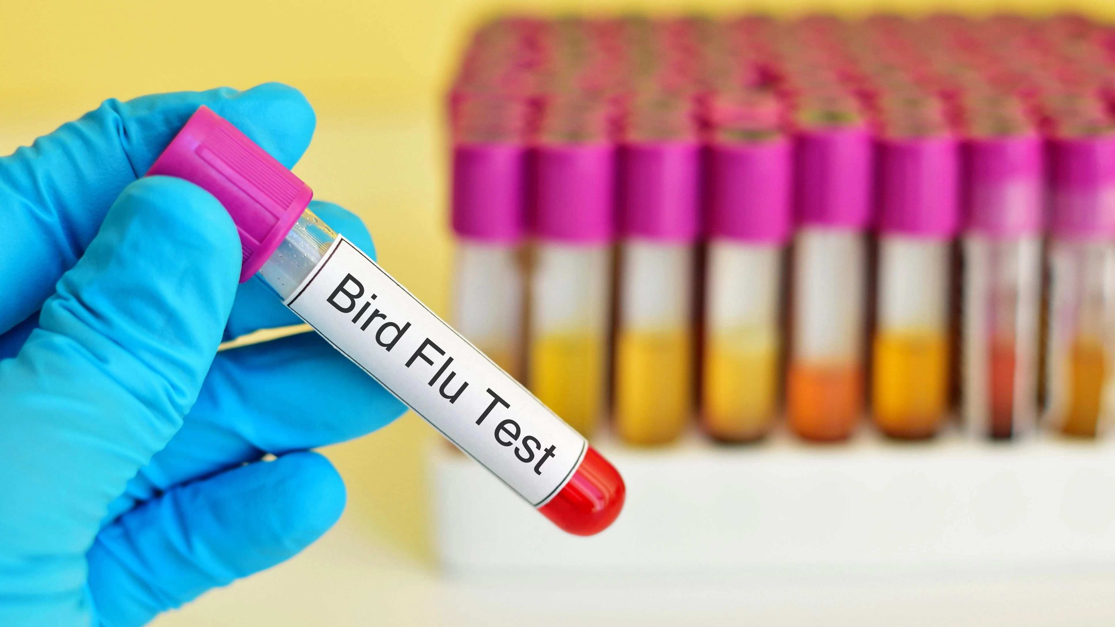 China confirms first-ever case of unique ‘bird flu’