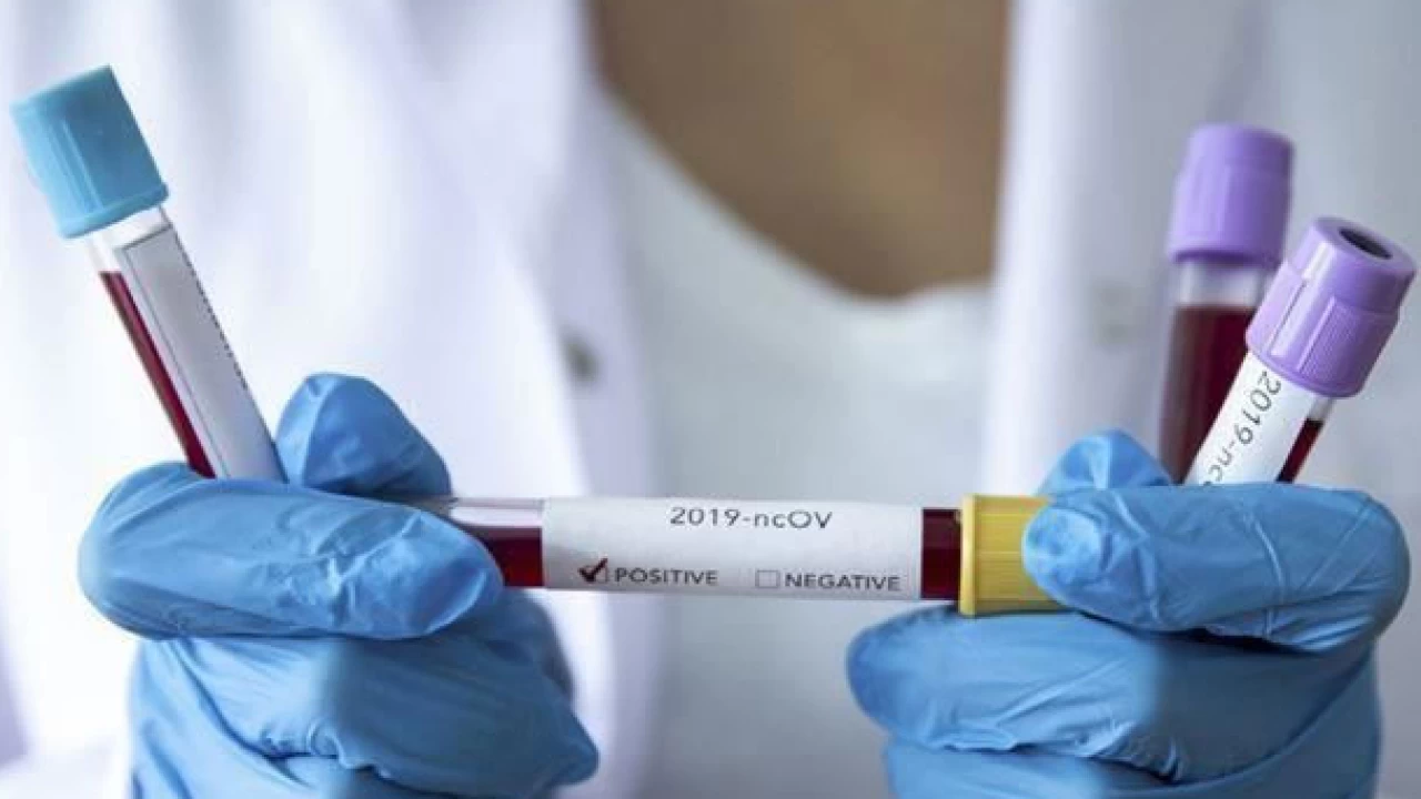 Coronavirus claims four lives in last 24 hour 