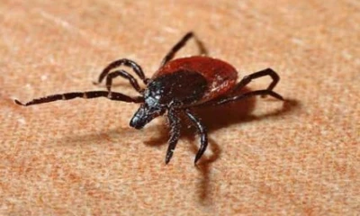 Karachi reports first Congo virus case