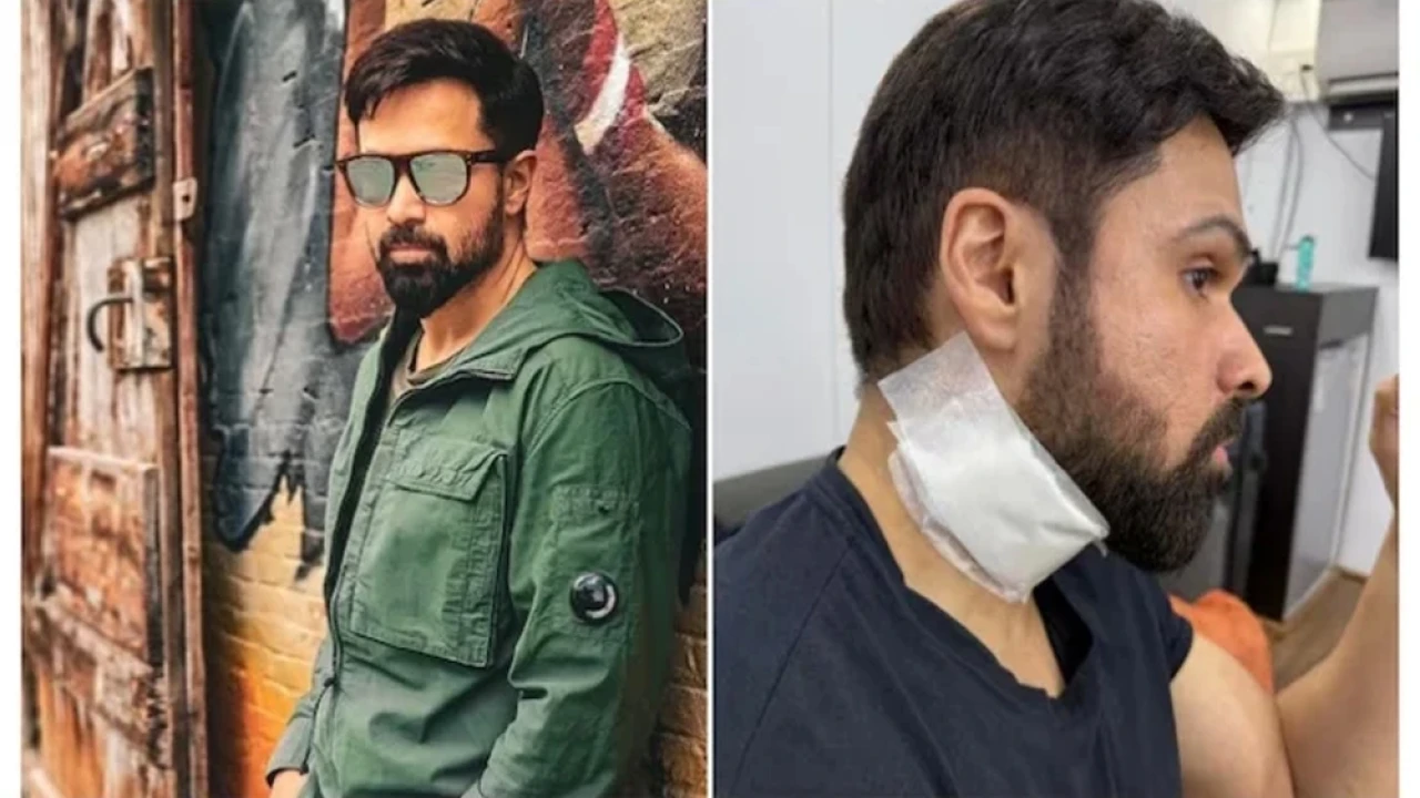 Emraan Hashmi seriously injured during shooting