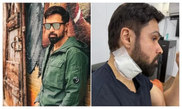 Emraan Hashmi seriously injured during shooting