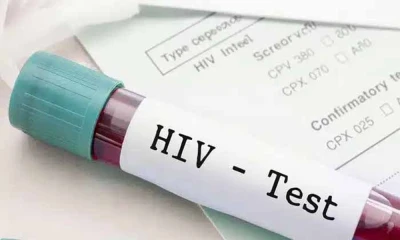 1,147 HIV cases reported in KP this year