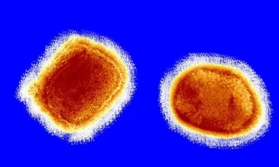 Israel, Switzerland and Austria confirm monkeypox cases