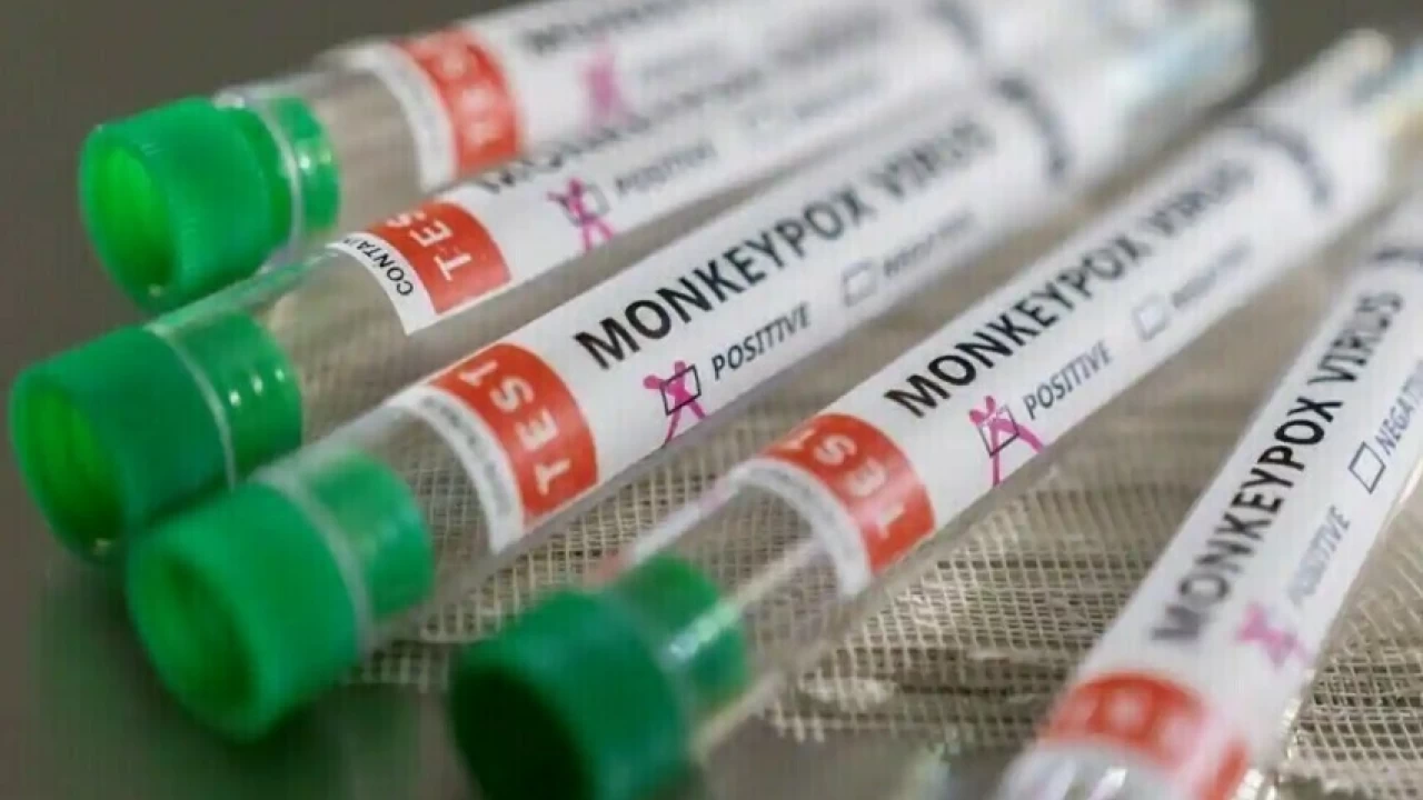 Canada reports 15 cases of monkeypox, more expected