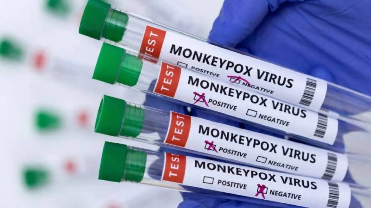 Pharmaceutical giant Roche develops monkeypox PCR tests