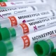 WHO declares global health emergency over monkeypox outbreak