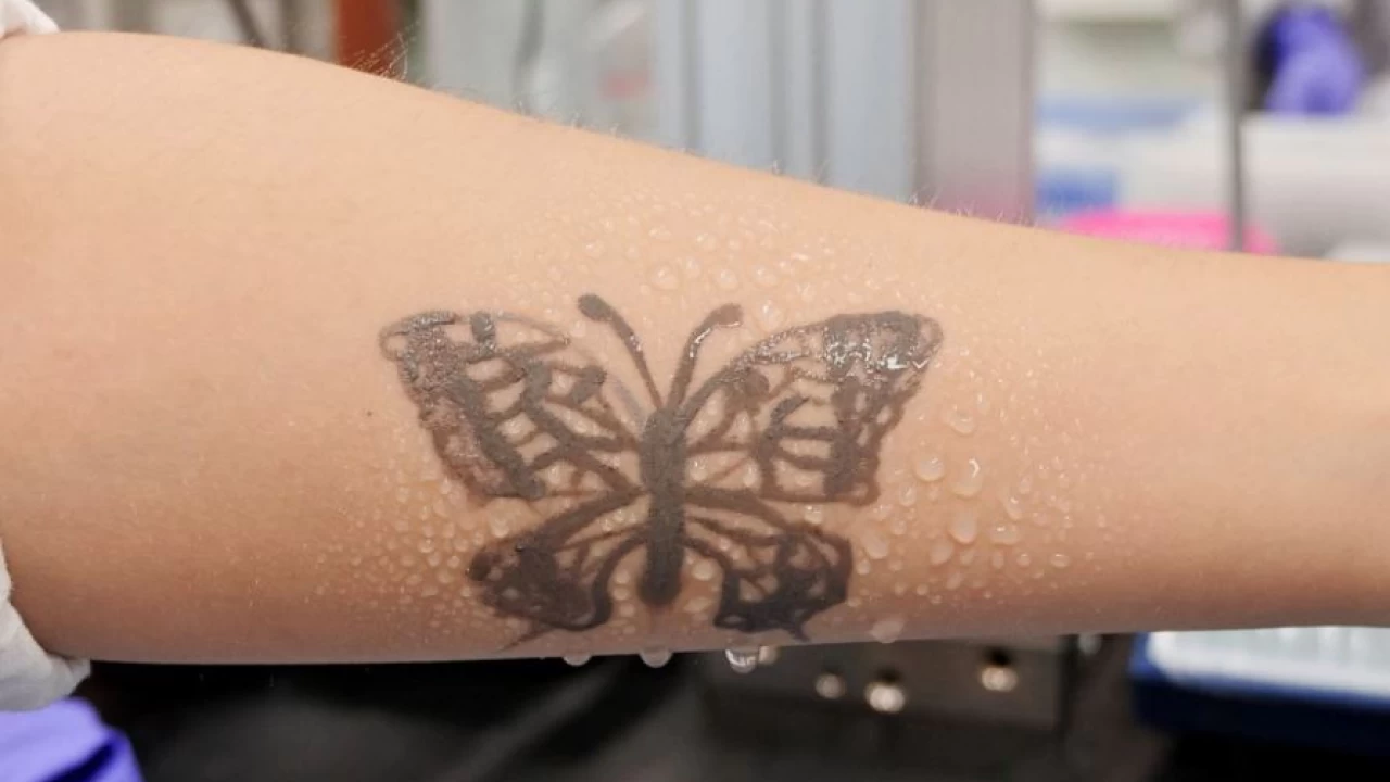 South Korea develops nanotech tattoo as health monitoring device