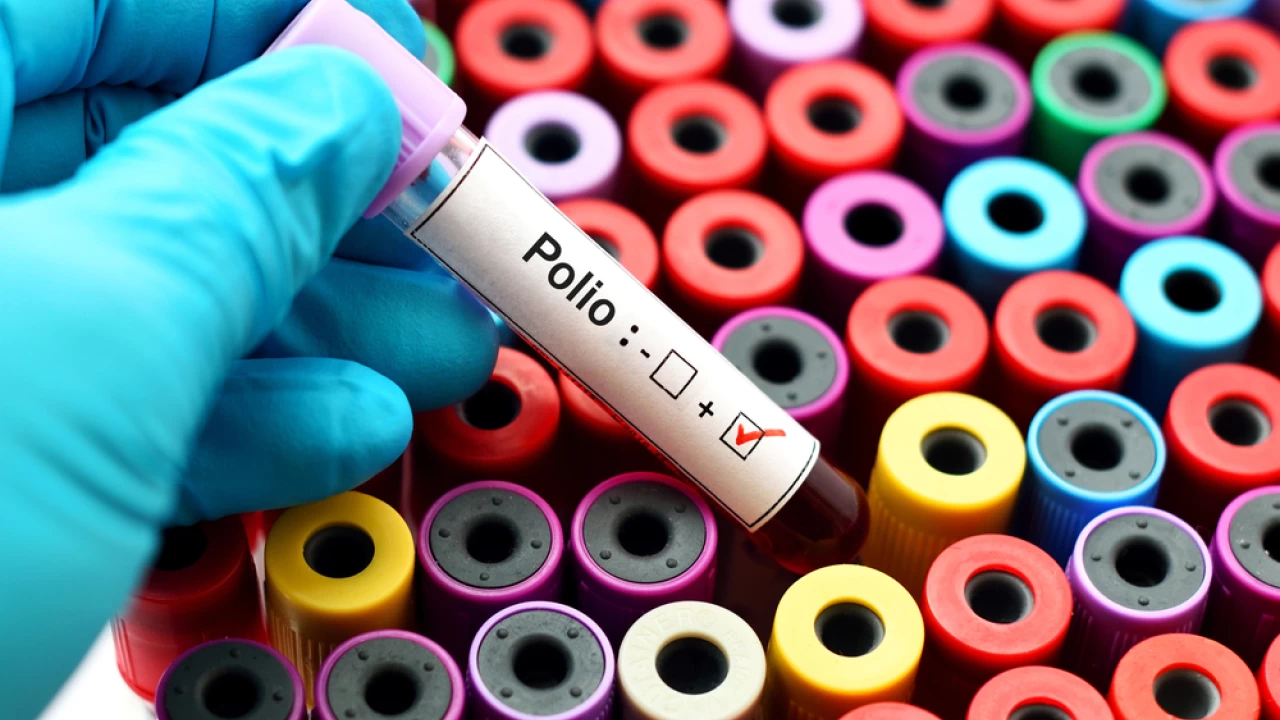 Polio virus found in New York City wastewater
