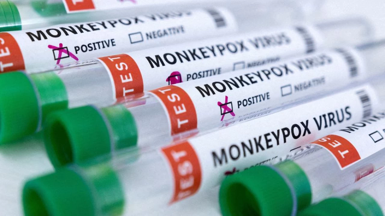 British scientists behind key COVID trial launch study to test monkeypox treatment
