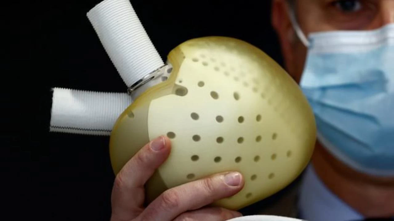 French implants ‘Artificial heart’ in woman 