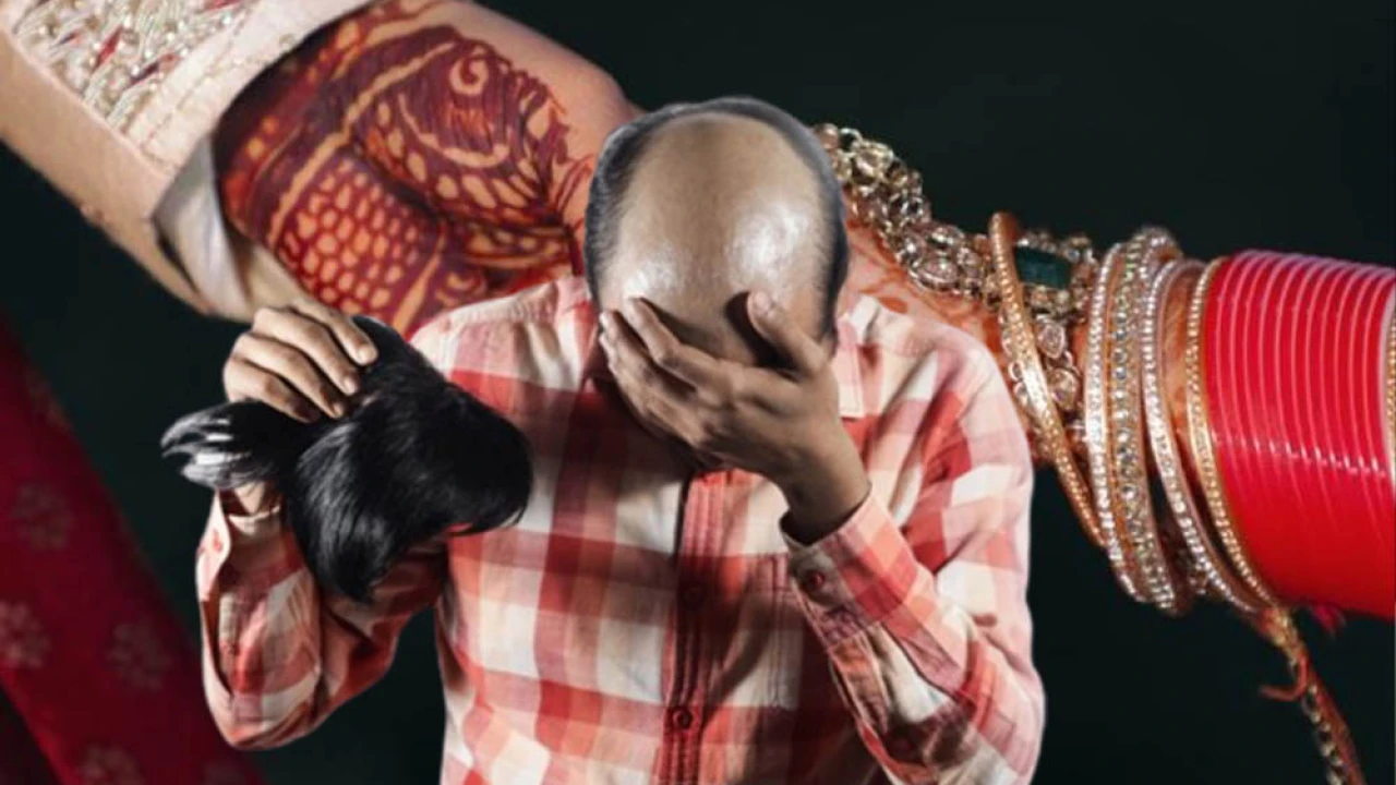 Bride’s family beat the groom for hiding baldness