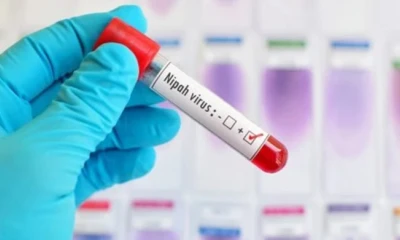 Punjab health dept issues alert as Nipah virus looms