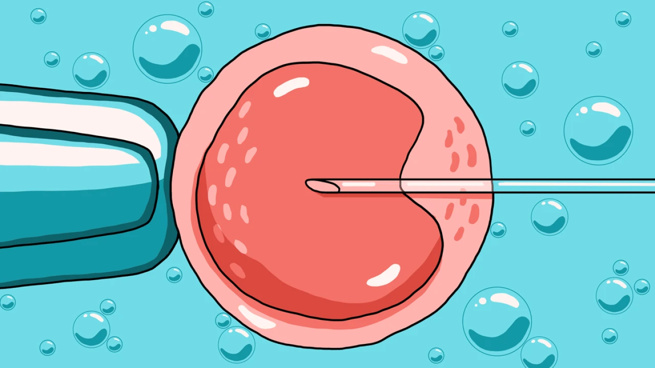 An illustrated guide to IVF